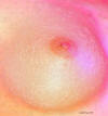Plastic surgery can bring damage